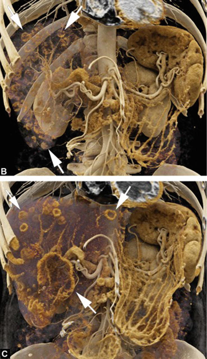 Volumetric rendering